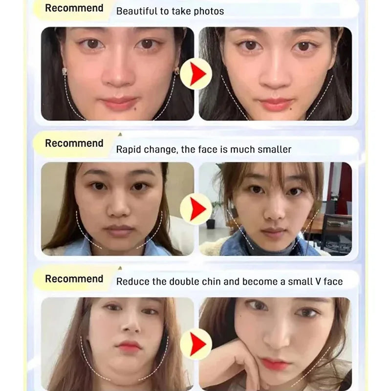 มาสก์หน้าเรียวสำหรับใส่ตอนนอน